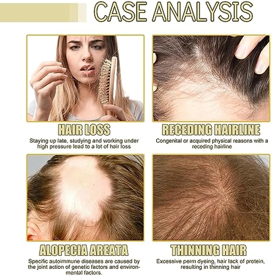 Veganic™ | Natural Hair Growth Oil